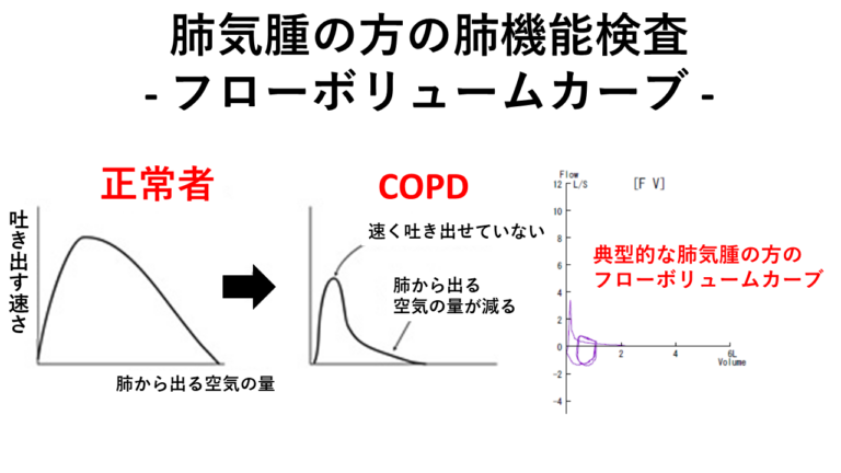 肺気腫の方の肺機能検査