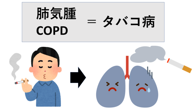 肺気腫ってどんな病気？