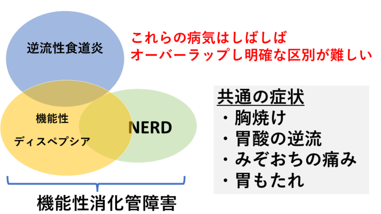 機能性ディスペプシア