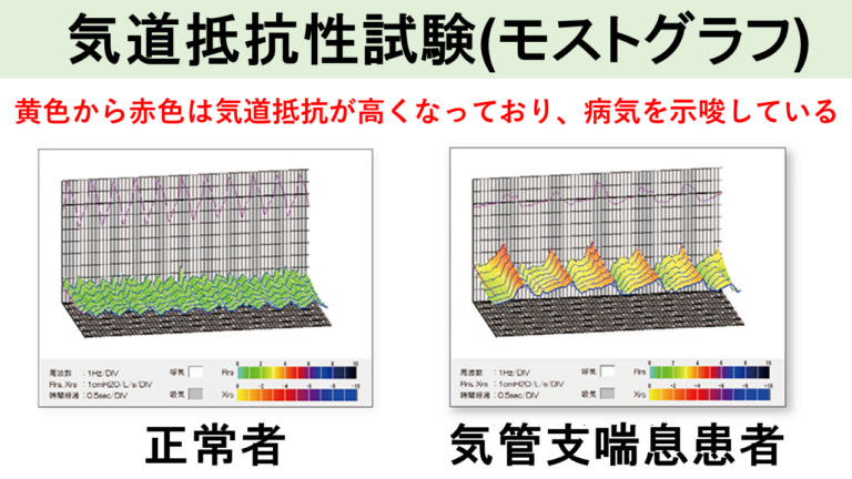 気道抵抗性試験(モストグラフ)