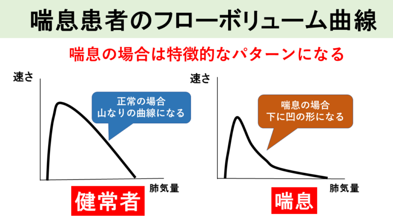 喘息患者のフローボリューム曲線