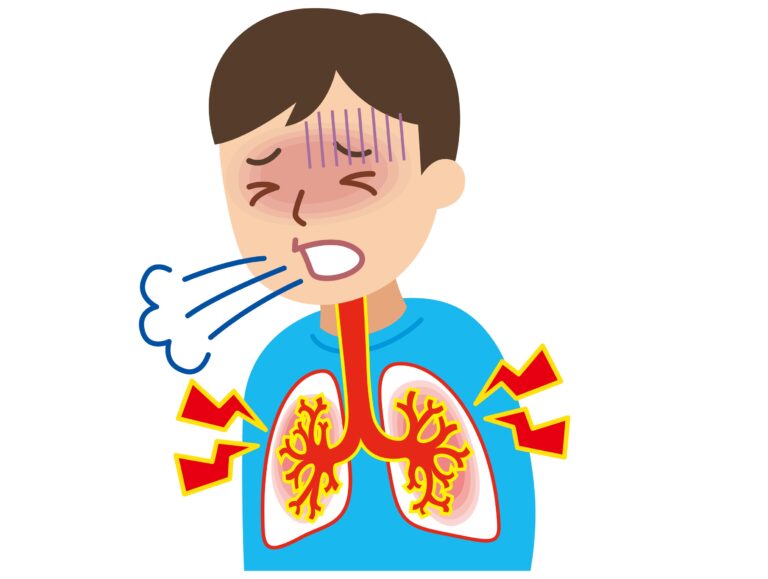 逆流性食道炎には様々な呼吸器病を合併する