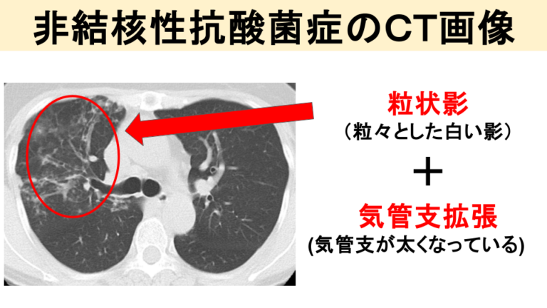 胸部レントゲン・CT検査