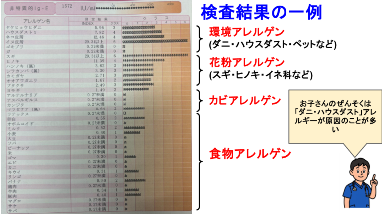 VIEW-39・単項目検査